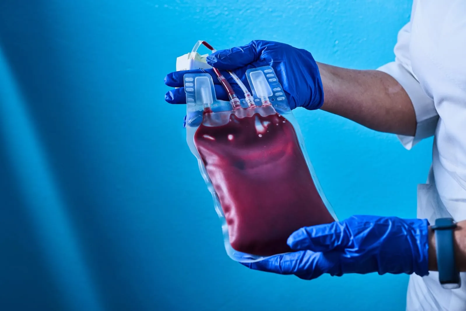 What's Behind That Bright Red Blood: Understanding BRBPR